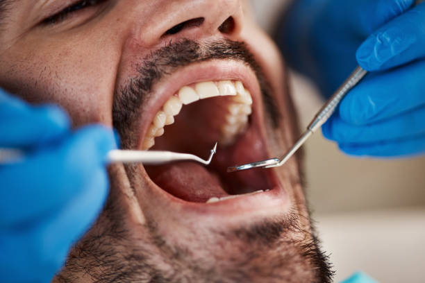 Best Emergency Treatment for Dental Infections or Abscesses in Argentine, MI