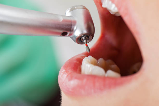 Best Weekend Emergency Dentist in Argentine, MI